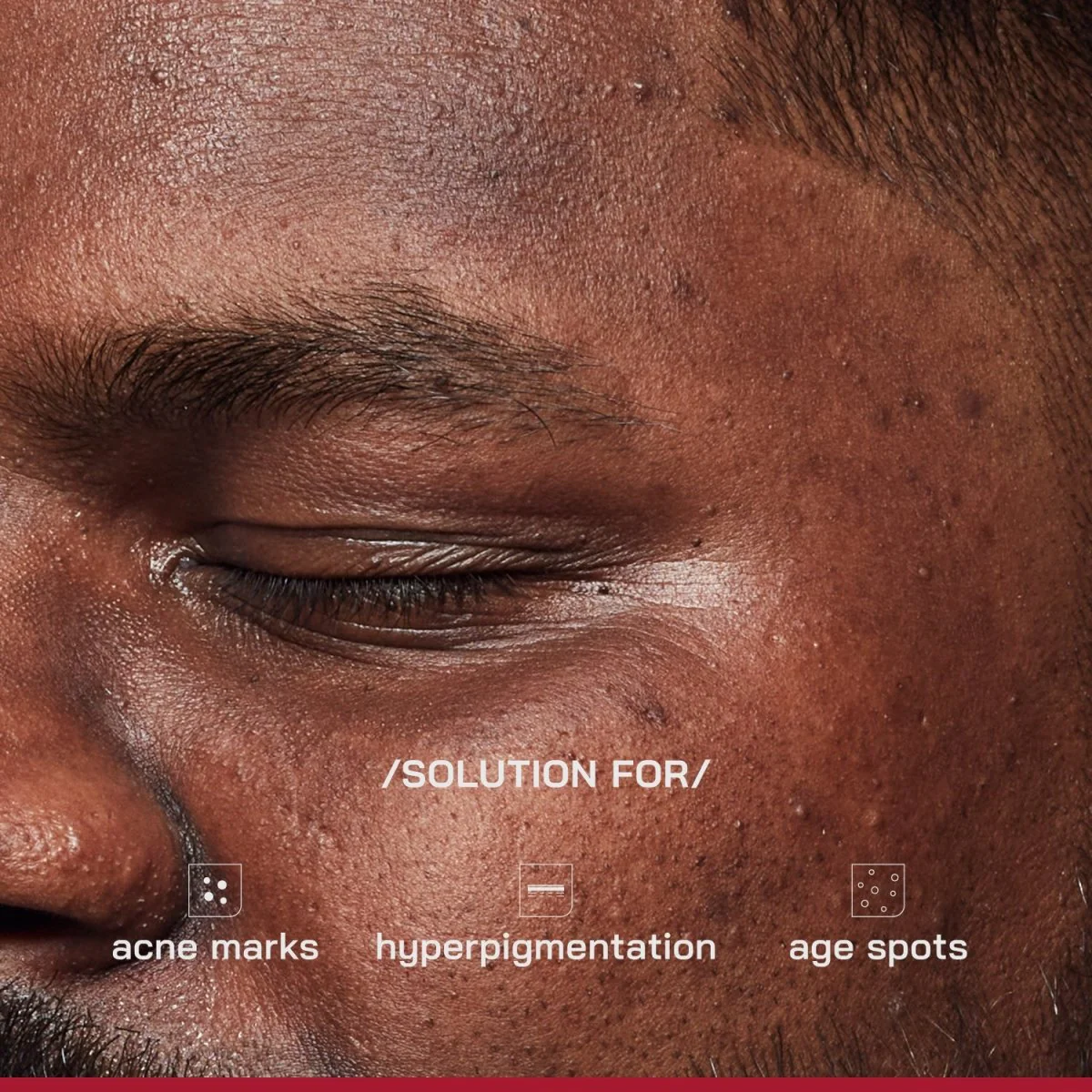 2% Alpha Arbutin Depigmentation Serum - Image 3
