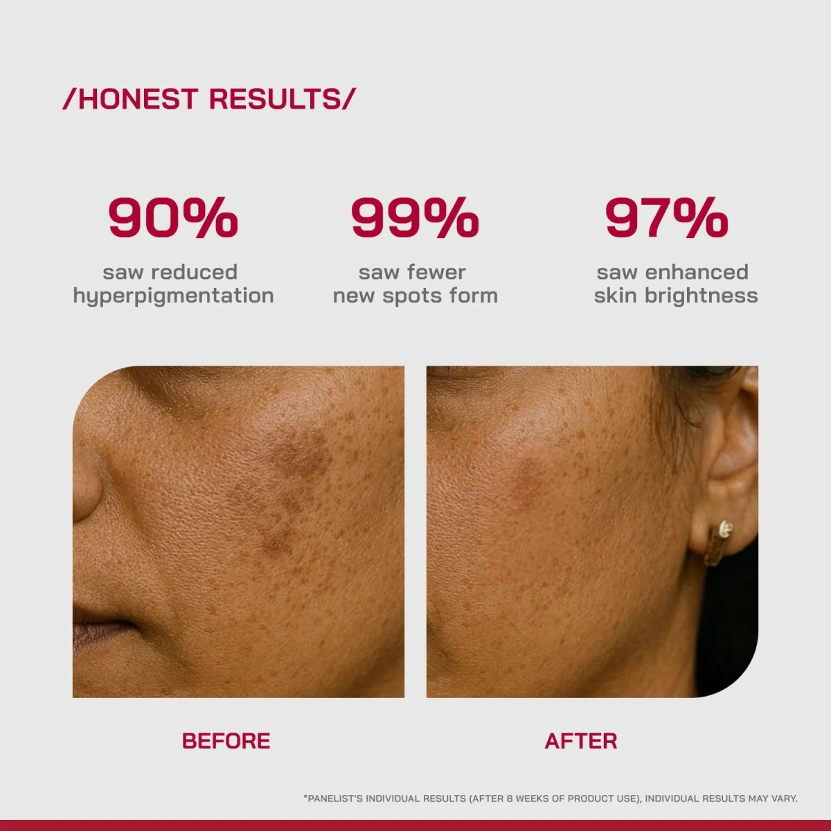 2% Alpha Arbutin Depigmentation Serum - Image 4